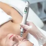Microneedling with Imedpen